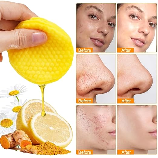 Turmeric Kojic Acid Cleansing Pads